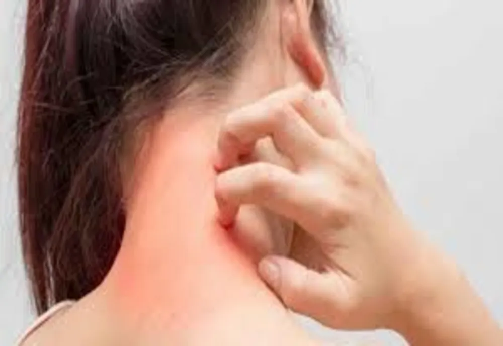 Primul medicament pentru cea mai întâlnită alergie