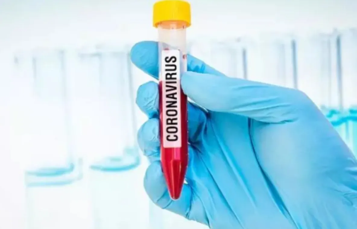 Coronavirus. Ar trebui să-ţi dezinfectezi telefonul? Ce spun experții