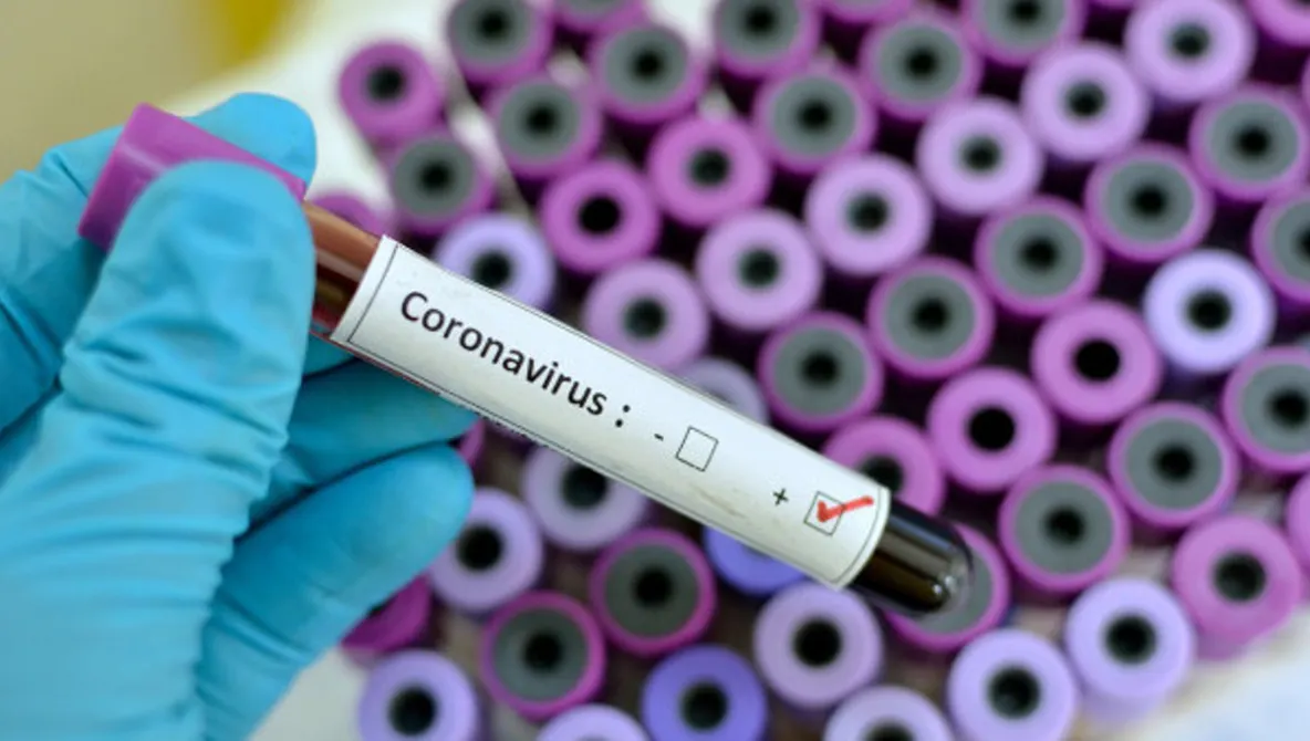 Cum afectează coronavirusul corpul uman și care sunt categoriile de risc