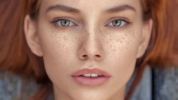 Dermatologii avertizează! Tendința periculoasă de pe TikTok: te poate orbi
