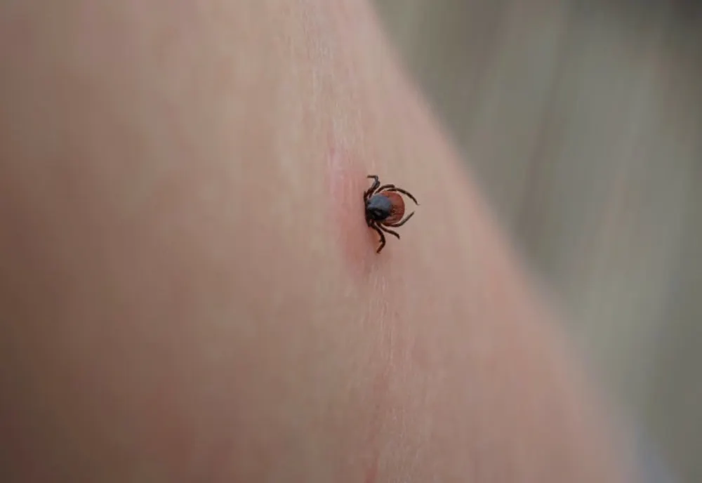 O alergie care pune viața în pericol, cauzată de mușcăturile de căpușe