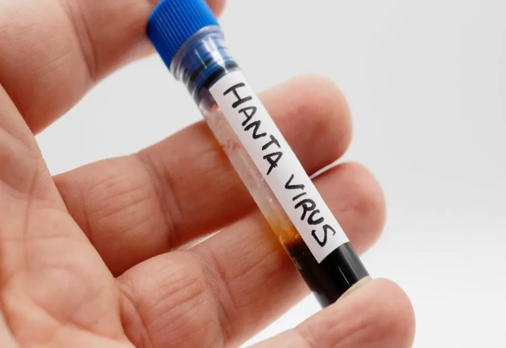 Recomandările OMS în cazul infectării cu hantavirus