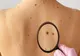 Trendul periculos de pe TikTok care poate crește riscul de cancer de piele