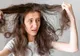 Scalp uscat și iritat: un dermatolog dezvăluie greșeala pe care o face toată lumea iarna